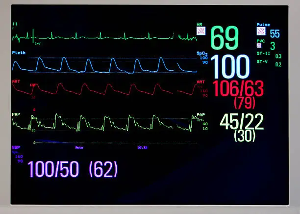 how to read ICU Monitors